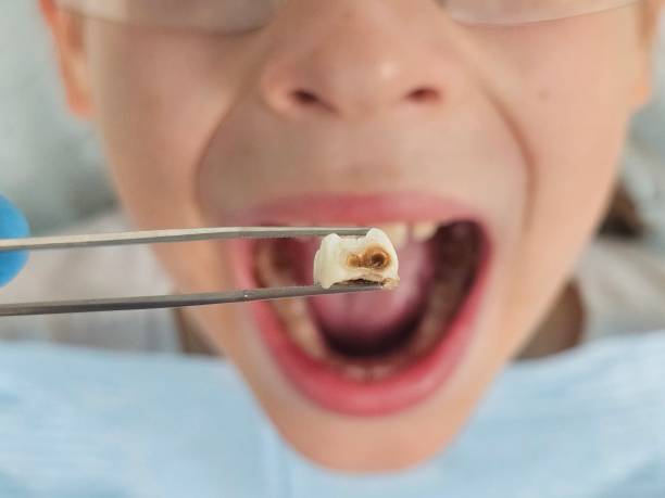 Best Weekend Emergency Dental Services in Eastpointe, MI